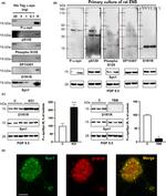 Phospho-alpha Synuclein (Ser129) Antibody in Western Blot (WB)