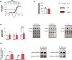 SERCA1 ATPase Antibody in Western Blot (WB)