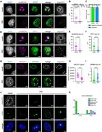 SRRM2 Antibody in Immunocytochemistry (ICC/IF)