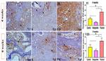 VEGF Antibody in Immunohistochemistry (IHC)