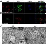 beta Amyloid Antibody in Immunomicroscopy (IM)