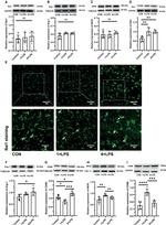 Arginase 1 Antibody in Western Blot (WB)