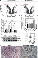 UHMK1 Antibody in Western Blot (WB)
