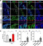 Lysozyme Antibody in Immunohistochemistry (IHC)