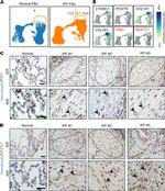 PIM1 Antibody in Immunohistochemistry (IHC)