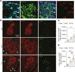 Insulin Antibody in Immunohistochemistry (IHC)