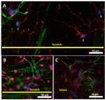 GFAP Antibody in Immunocytochemistry (ICC/IF)