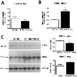 TRPV2 Antibody in Western Blot (WB)