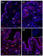 CYP24A1 Antibody in Immunohistochemistry (IHC)