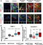 TIMP1 Antibody in Immunohistochemistry (IHC)