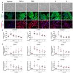 Vimentin Antibody in Immunocytochemistry (ICC/IF)