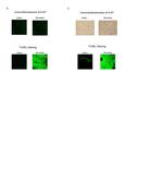 Ki-67 Antibody in Immunohistochemistry (IHC)