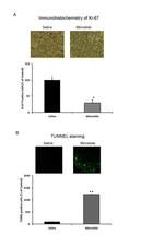 Ki-67 Antibody in Immunohistochemistry (IHC)