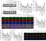 RIPX Antibody in Western Blot, Immunohistochemistry, Immunocytochemistry (WB, IHC, ICC/IF)