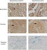 alpha-1 Antitrypsin Antibody in Immunohistochemistry (IHC)