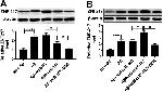 ZNF217 Antibody in Western Blot (WB)
