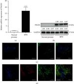 PAGE4 Antibody in Western Blot (WB)