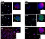 CD274 (PD-L1, B7-H1) Antibody in Immunohistochemistry (Paraffin) (IHC (P))