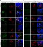 ZSCAN1 Antibody in Immunocytochemistry (ICC/IF)