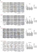 Caspase 1 p20 (Cleaved Asp296) Antibody in Immunohistochemistry (IHC)