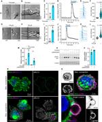 Phospho-MYL2 (Tyr118) Antibody in Immunocytochemistry (ICC/IF)