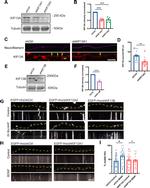 KIF13A Antibody in Immunocytochemistry (ICC/IF)