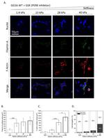Filamin A Antibody in Immunocytochemistry (ICC/IF)