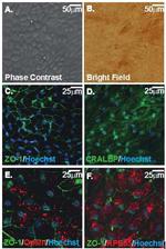 ZO-1 Antibody in Immunocytochemistry (ICC/IF)