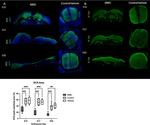 Doublecortin Antibody in Immunohistochemistry (IHC)