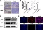 Orexin Receptor 2 Antibody in Immunocytochemistry (ICC/IF)