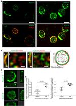 Septin 2 Antibody in Immunocytochemistry (ICC/IF)