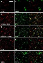 CCR2 Antibody in Immunohistochemistry (Frozen) (IHC (F))