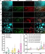 S100A8 Antibody in Immunocytochemistry (ICC/IF)