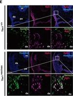 Rat IgG (H+L) Cross-Adsorbed Secondary Antibody in Immunohistochemistry, Immunohistochemistry (Frozen) (IHC, IHC (F))