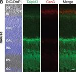 Mouse IgG (H+L) Cross-Adsorbed Secondary Antibody in Immunocytochemistry (ICC/IF)