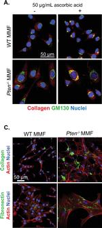 Rabbit IgG (H+L) Cross-Adsorbed Secondary Antibody in Immunocytochemistry (ICC/IF)
