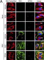 Goat IgG (H+L) Cross-Adsorbed Secondary Antibody in Immunocytochemistry (ICC/IF)