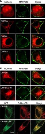 Mouse IgM (Heavy chain) Cross-Adsorbed Secondary Antibody in Immunocytochemistry (ICC/IF)