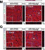 Mouse IgG (H+L) Highly Cross-Adsorbed Secondary Antibody in Immunohistochemistry (IHC)