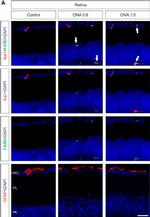 Rabbit IgG (H+L) Highly Cross-Adsorbed Secondary Antibody in Immunohistochemistry (PFA fixed) (IHC (PFA))