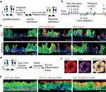 FOXJ1 Antibody in Immunohistochemistry, Immunohistochemistry (PFA fixed), Immunocytochemistry (IHC, IHC (PFA), ICC/IF)