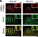 Rabbit IgG (H+L) Cross-Adsorbed Secondary Antibody in Immunohistochemistry (IHC)