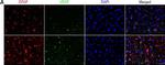 Rabbit IgG (H+L) Highly Cross-Adsorbed Secondary Antibody in Immunohistochemistry (Frozen) (IHC (F))