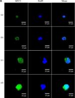 Rabbit IgG (H+L) Secondary Antibody in Immunocytochemistry (ICC/IF)