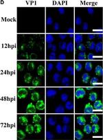 Rabbit IgG (H+L) Cross-Adsorbed Secondary Antibody in Immunocytochemistry (ICC/IF)