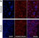 Rabbit IgG (H+L) Cross-Adsorbed Secondary Antibody in Immunohistochemistry (Paraffin) (IHC (P))