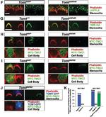 Mouse IgG (H+L) Cross-Adsorbed Secondary Antibody in Immunocytochemistry (ICC/IF)