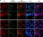 Rabbit IgG (H+L) Cross-Adsorbed Secondary Antibody in Immunohistochemistry (IHC)