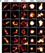 Rabbit IgG (H+L) Cross-Adsorbed Secondary Antibody in Immunocytochemistry (ICC/IF)