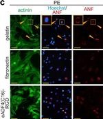 Mouse IgG (H+L) Highly Cross-Adsorbed Secondary Antibody in Immunocytochemistry (ICC/IF)